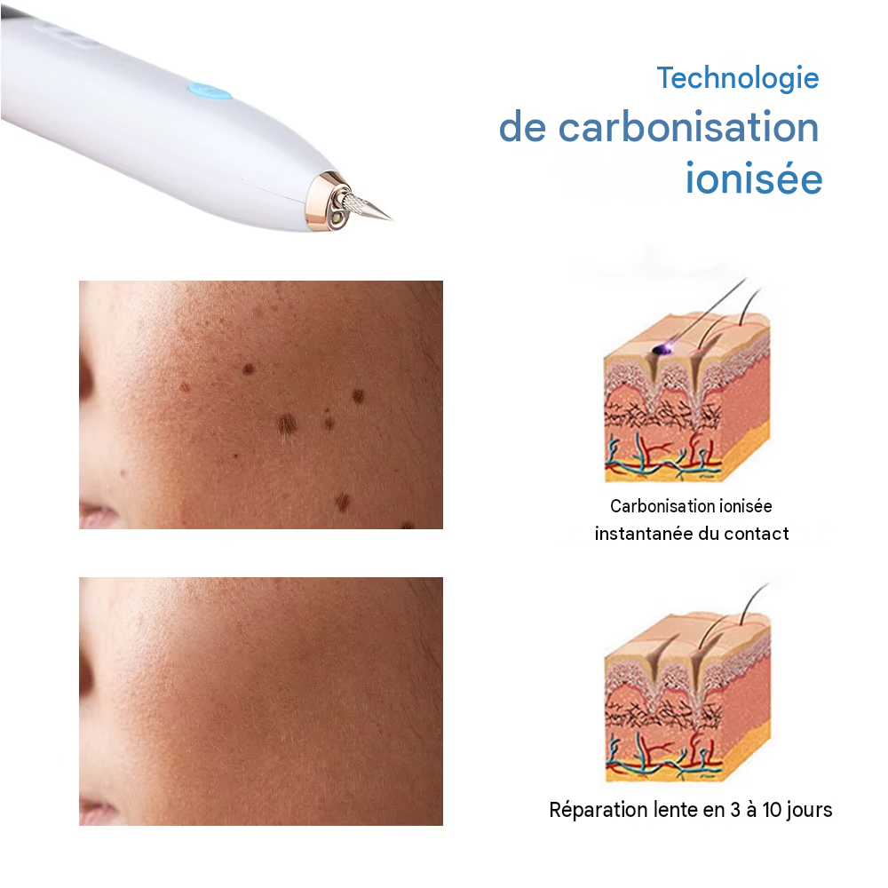 Stylo plasma LED, éliminateur de verrues étiquettes cutanées et taches
