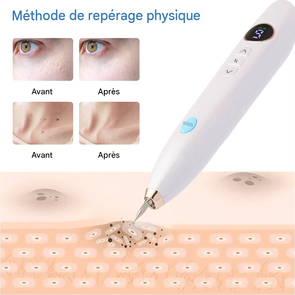 Stylo plasma LED, éliminateur de verrues étiquettes cutanées et taches