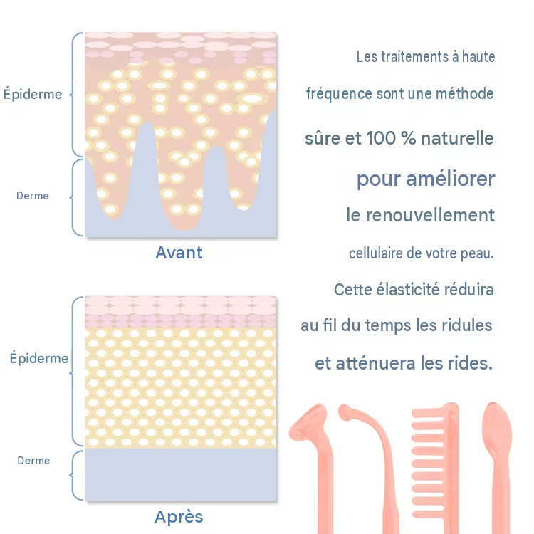 Machine à Tube de verre à électrode 4 en 1, haute fréquence, baguette d'acné, Spa pour le visage, soins de la peau, électrothérapie