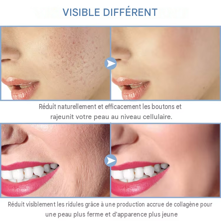 Machine à Tube de verre à électrode 4 en 1, haute fréquence, baguette d'acné, Spa pour le visage, soins de la peau, électrothérapie