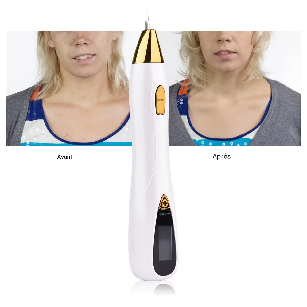 Stylo plasma LED, éliminateur de verrues étiquettes cutanées et taches
