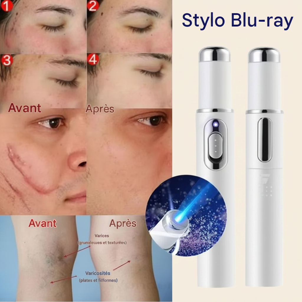 Stylo laser anti-acné et thérapie du visage par luminothérapie LED bleue