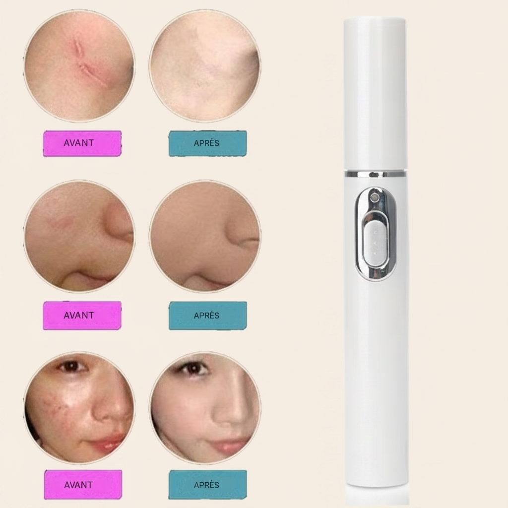 Stylo laser anti-acné et thérapie du visage par luminothérapie LED bleue