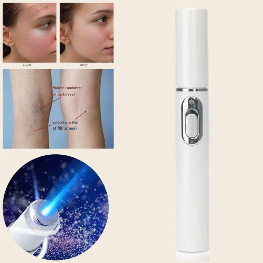 Stylo laser anti-acné et thérapie du visage par luminothérapie LED bleue