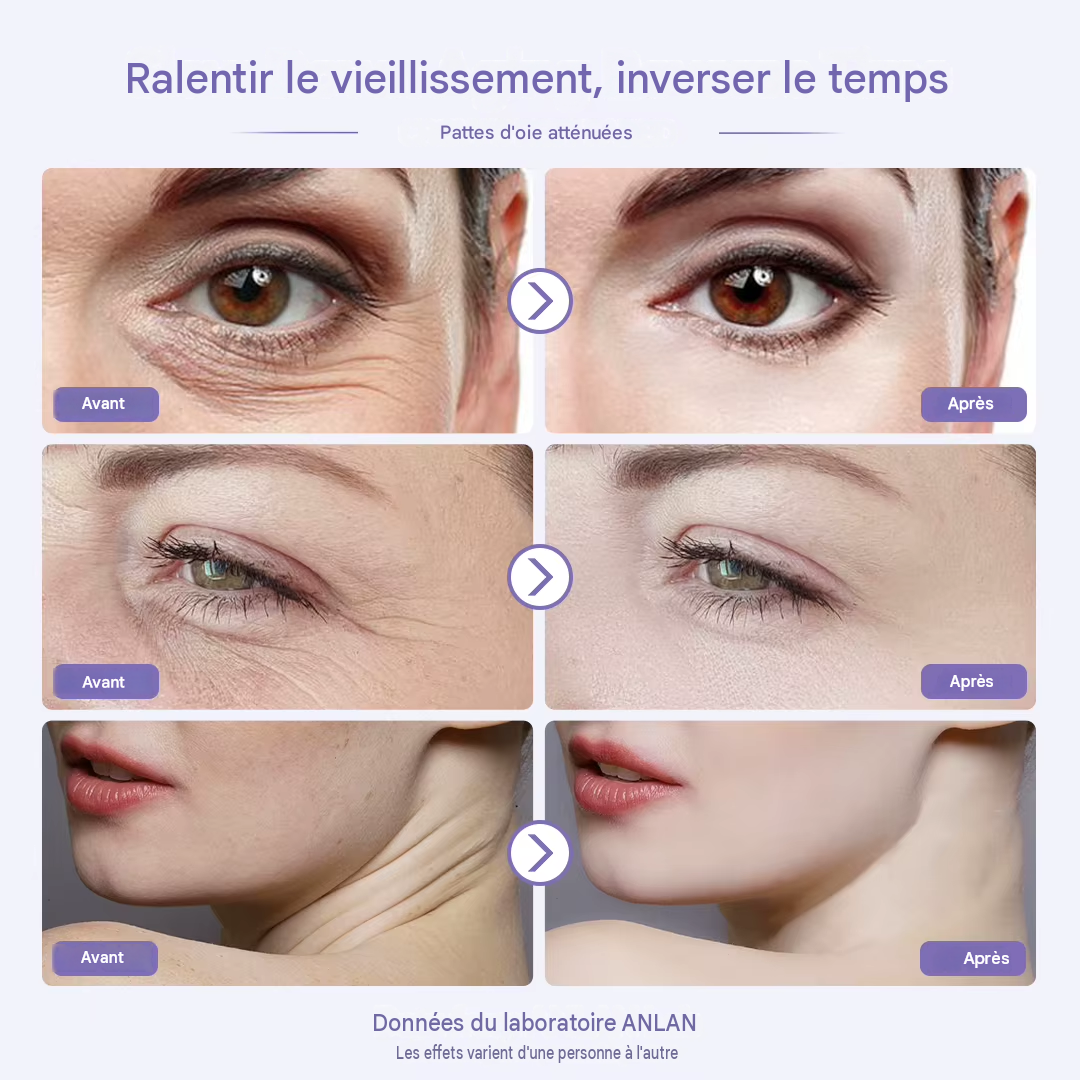 Masseur facial EMS multifonction